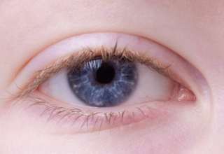 Fünf Fragen und Antworten zur Augengrippe