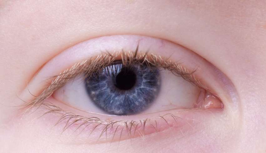 Fünf Fragen und Antworten zur Augengrippe